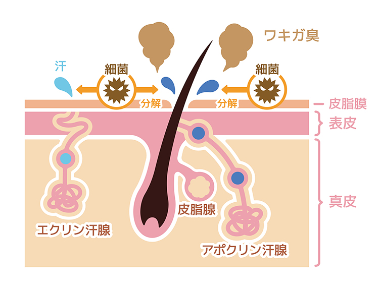 腋臭症（わきが）とは