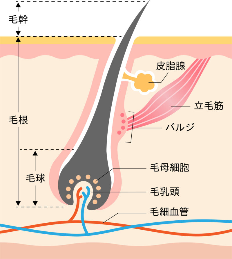 宇都宮で医療脱毛を提供しているたかだ形成外科クリニックの医療脱毛の仕組みイメージ図